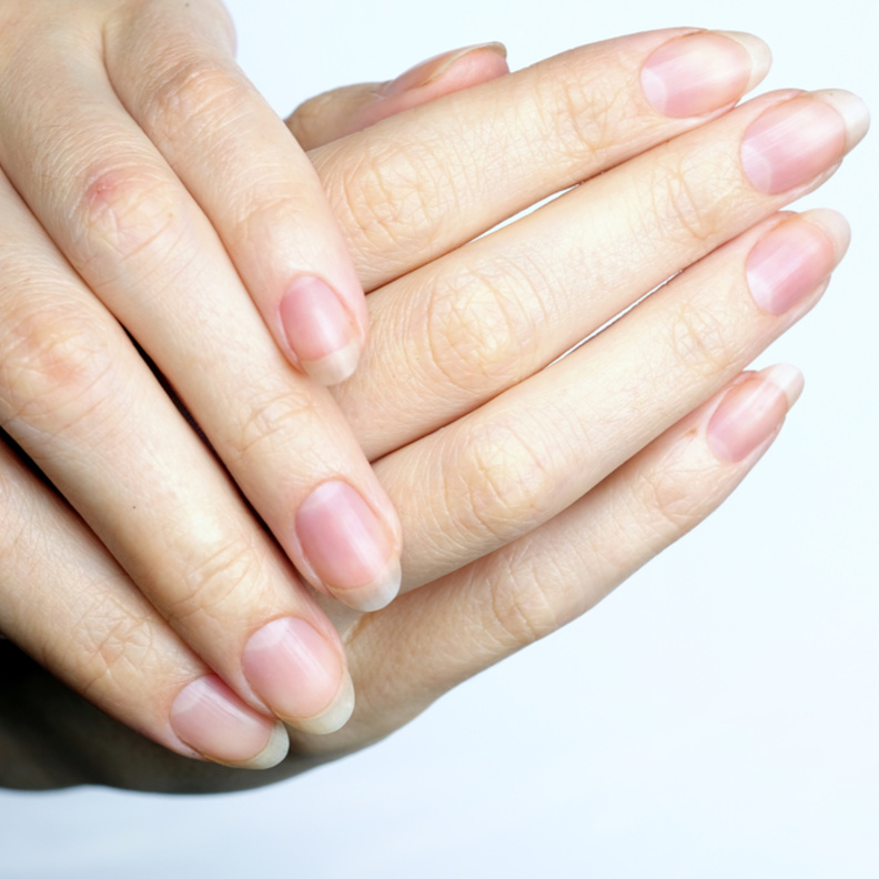 فوائد زيت اللبان لتقوية الأظافر الضعيفة والهشة