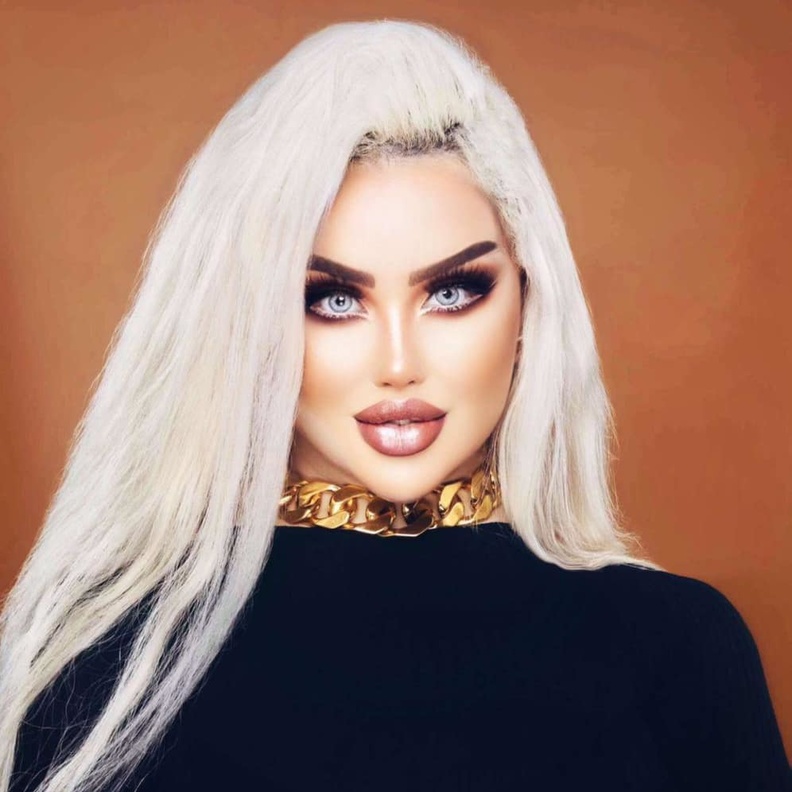 العراقية داليا نعيم تخضع للمزيد من عمليات التجميل