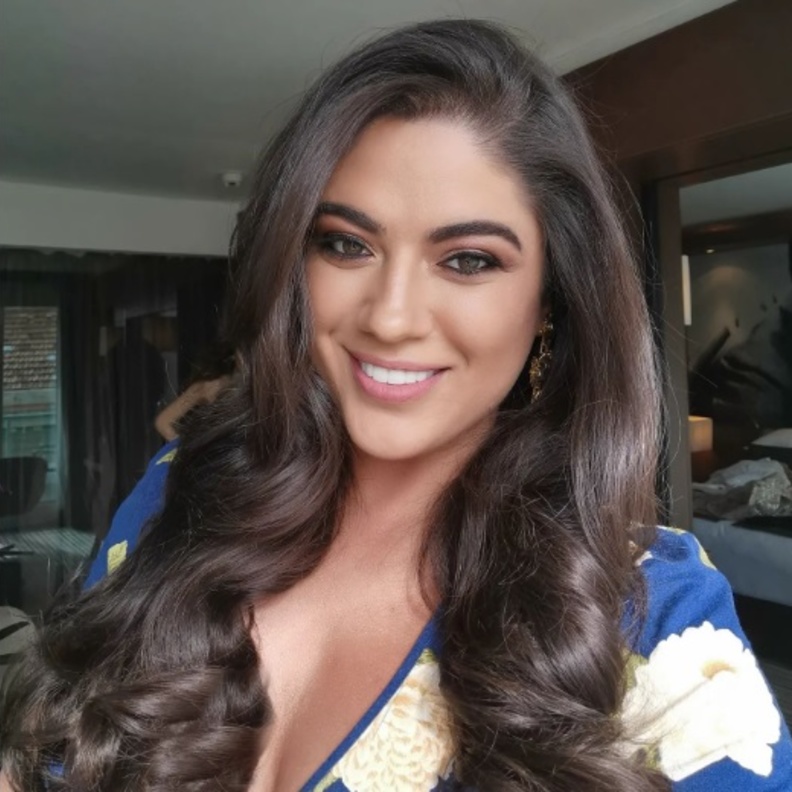  نادين ويلسون نجيم تطل بجرأة بدون فلتر وتكشف عن عيوب بشرتها