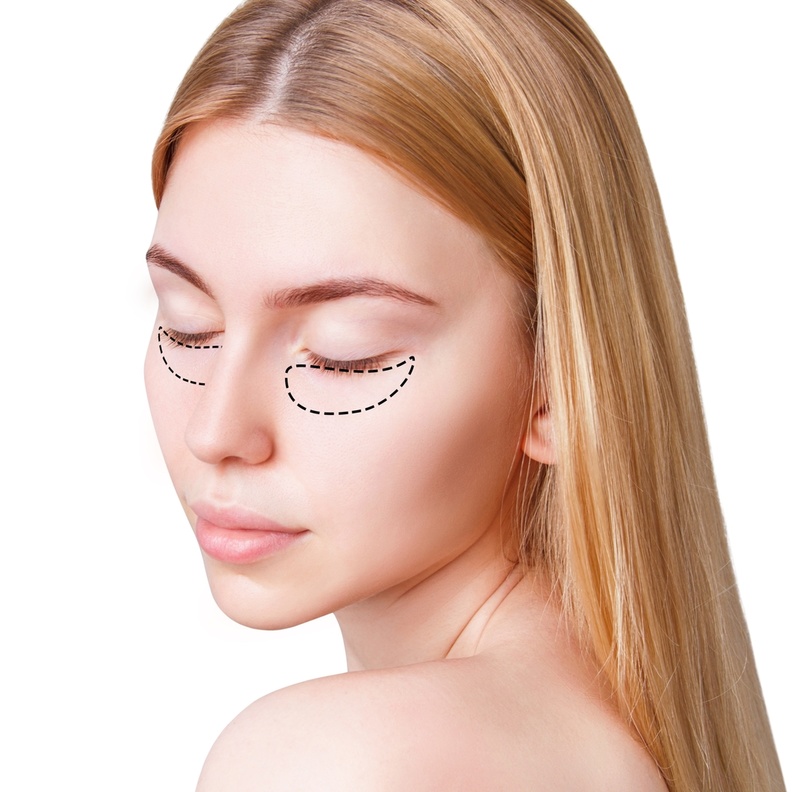 نصائح وأهم التعليمات قبل وبعد حقن الفيلر تحت العين