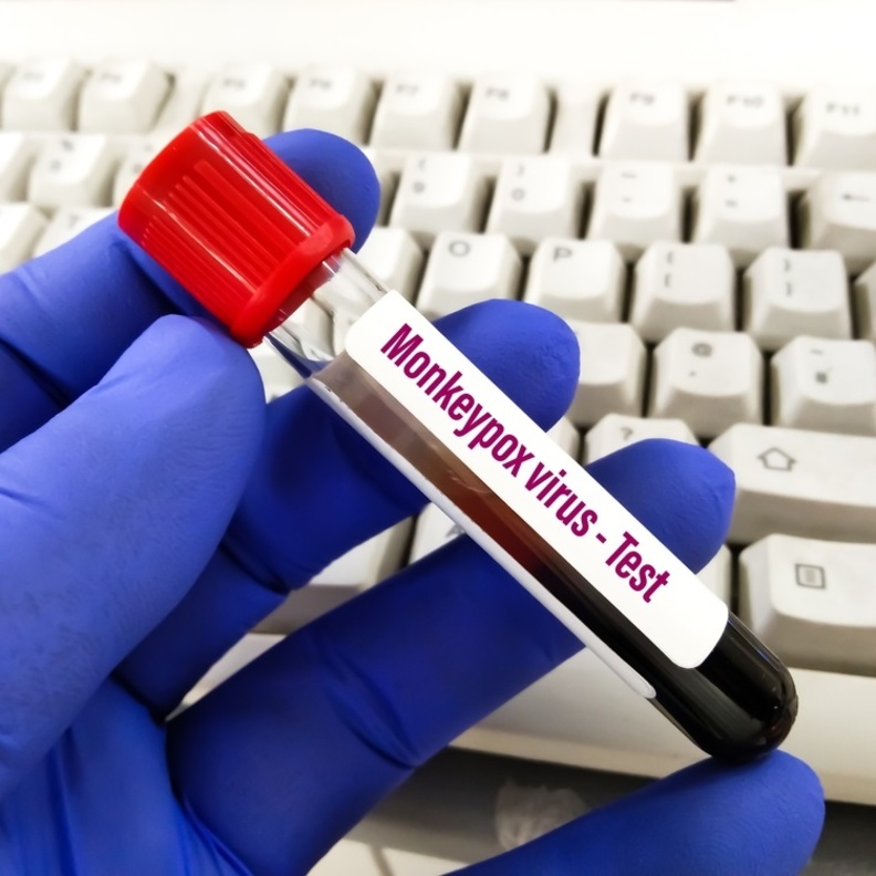 اهم اعراض جدري القرود وطرق الوقاية منه