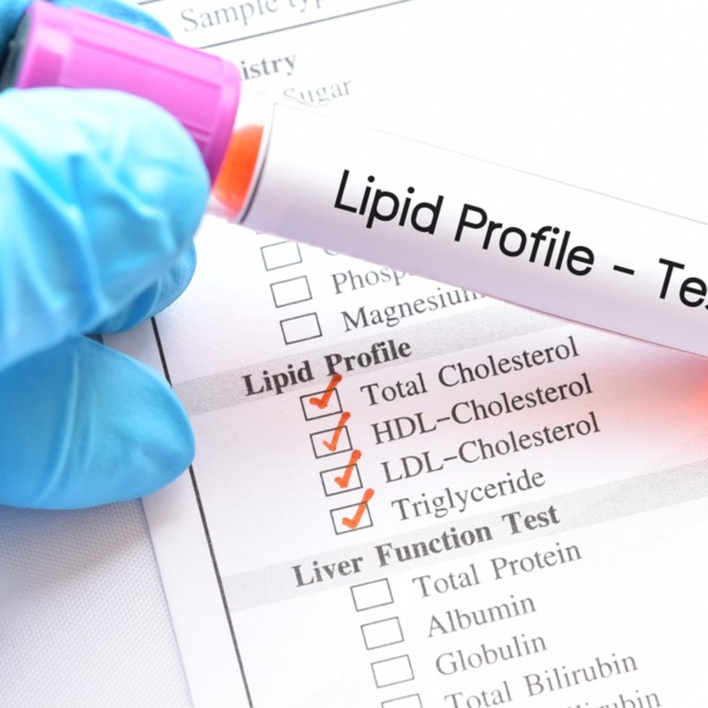 ما هو فرط شحميات الدم وكيف يمكن الوقاية منه