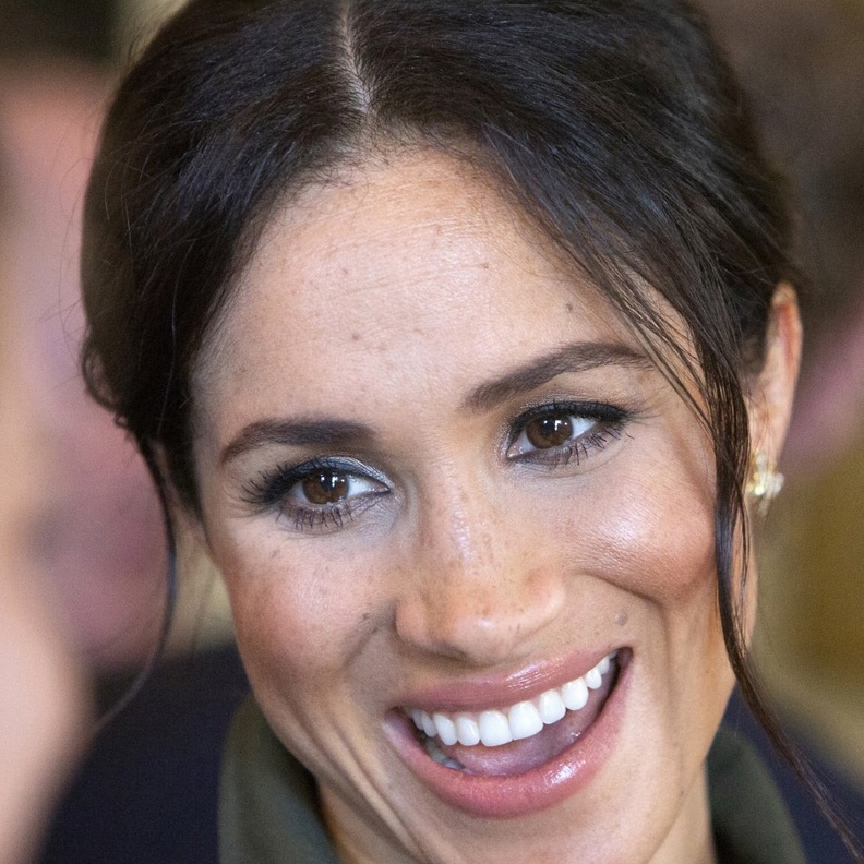 هل خضعت ميغان ماركل لعملية تجميل في أسنانها؟
