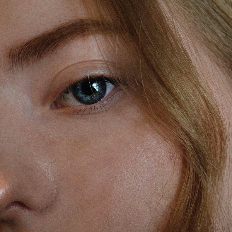 أضرار الفيلر تحت العين وطريقة حقنه الصحيحة