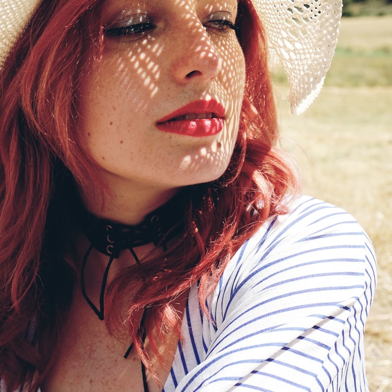 طرق إزالة النمش من الوجه قبل موسم الصيف الحار بخطوات بسيطة