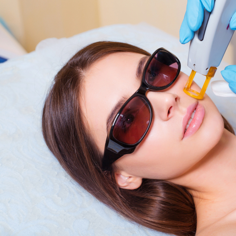 طريقة تفتيح البشرة الداكنة بالليزر وأهم أضرارها