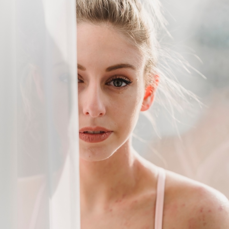 خلطات لعلاج التعرق الزائد قبل عيد الاضحى 2022