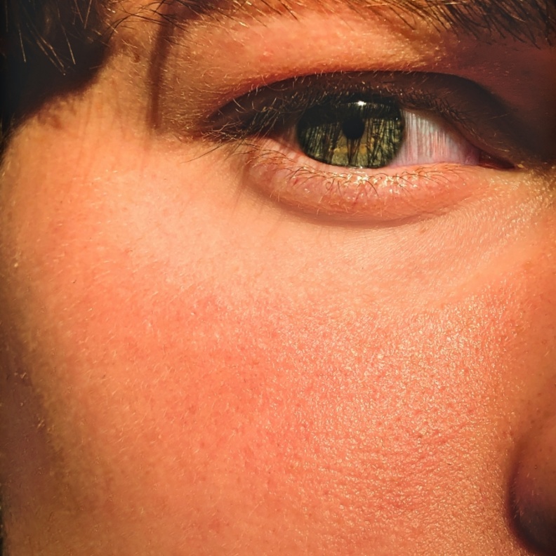 طريقة عمل ماسك اليار والبابونج مذهلة لعلاج الهالات السوداء في اسرع وقت