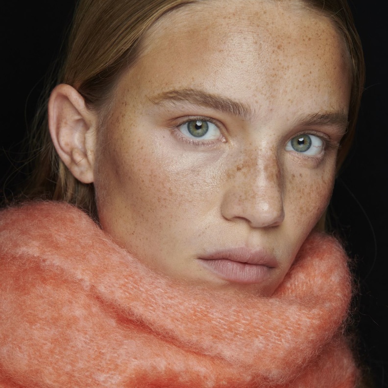 طرق إزالة النمش من الوجه مع بداية موسم الخريف