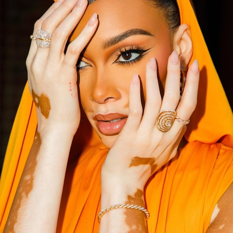 ويني هارلو Winnie Harlow من أشهر عارضات الأزياء حول العالم.. ماذا تختار تصاميم مجوهرات لتٌزيين إطلالاتها؟ 