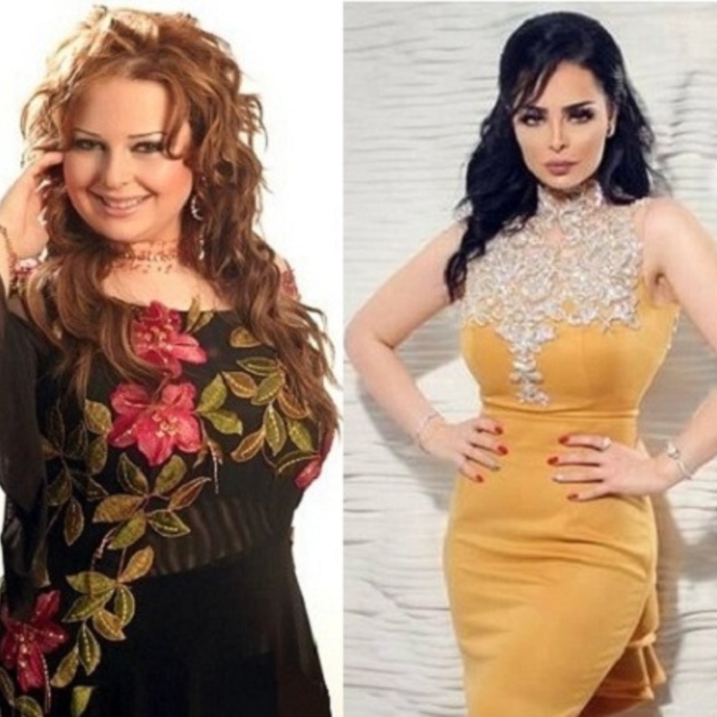 ديانا كرزون قبل وبعد التخسيس