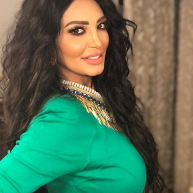 سالي عبد السلام تصاب بالصلع