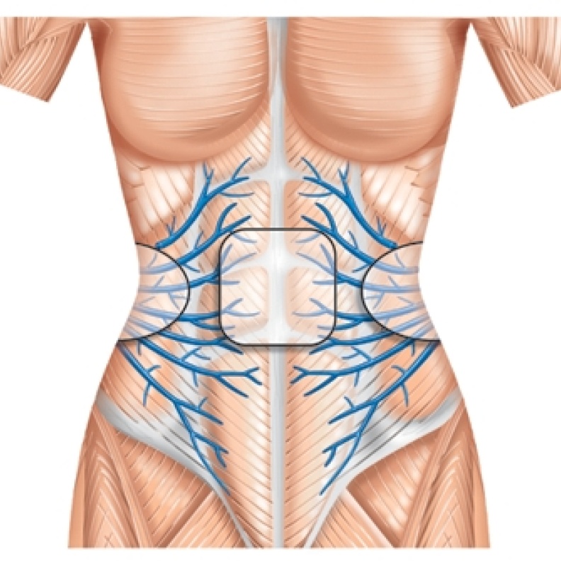 إحصلي على بطن مشدود وخصر نحيف مع جهاز "سلندرتون" 