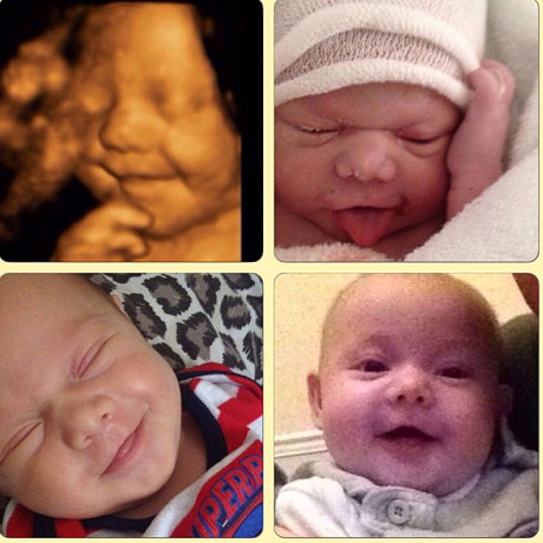 طفل يحافظ على ابتسامته في رحم أمه وبعد الولادة