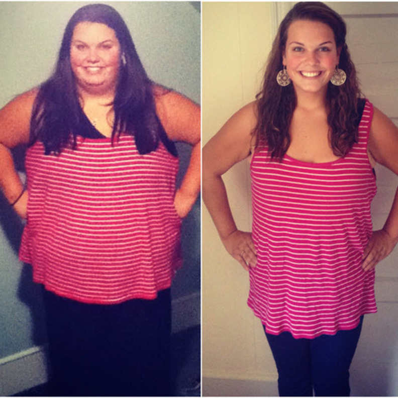 صورة توضح ماري قبل وبعد العملية الجراحية التي افقدتها نصف وزنها