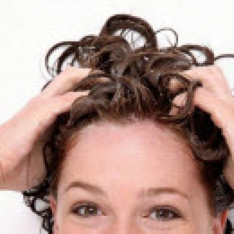 الخل يقضي على  قشرة الشعر