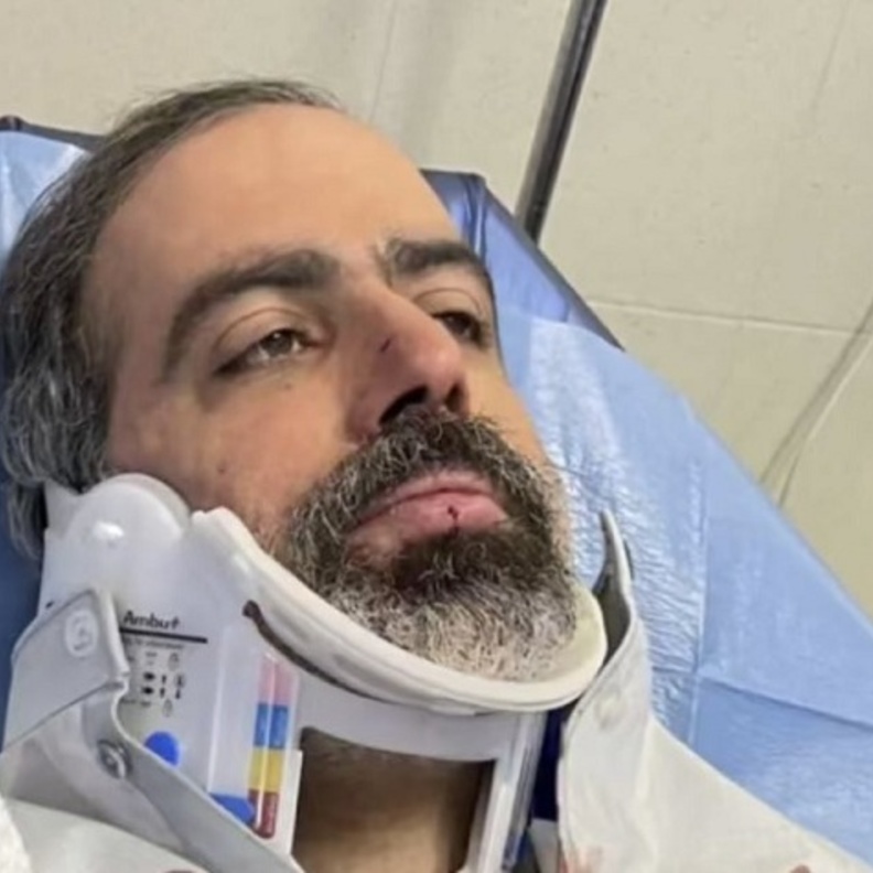 الفنان عبدالله التركماني يتعرض لحادث سير خطير - صورة من انستغرام مي العيدان