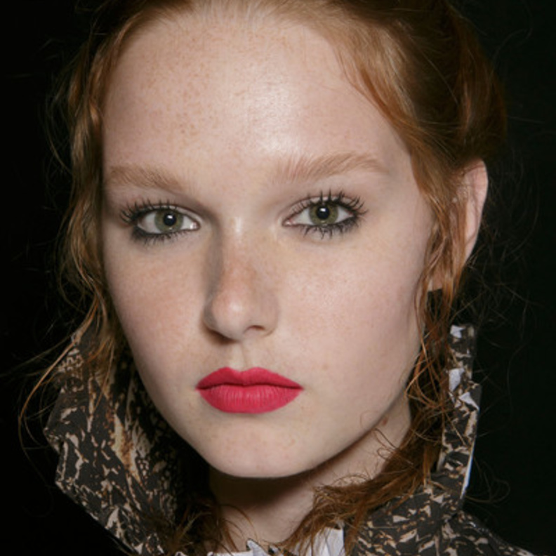 الحمرة البارزة والناشفة أيضاً حاضرة