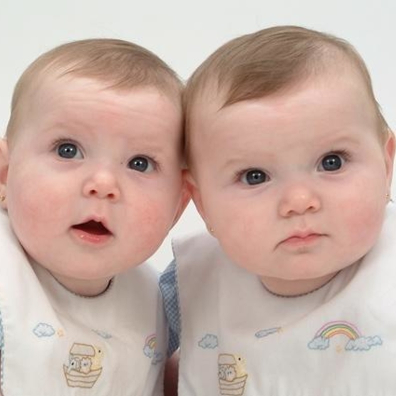 إمرأة تنجب توأم من رجلين مختلفين 