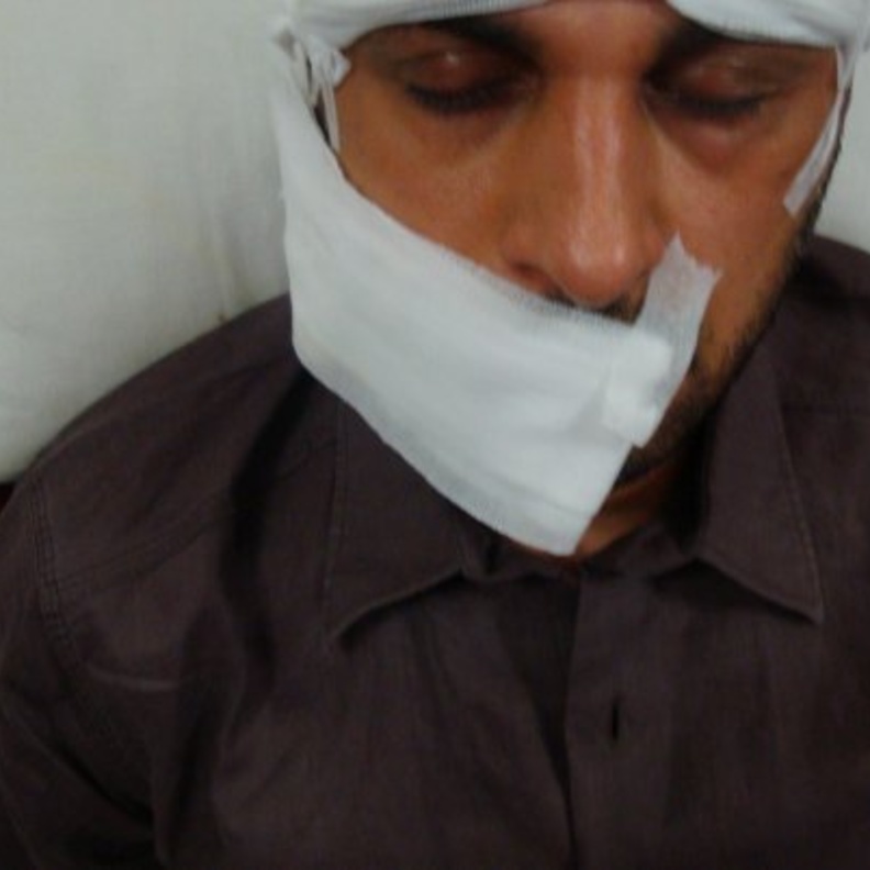 ماجد المهندس نجى من حادث السير بأعجوبة