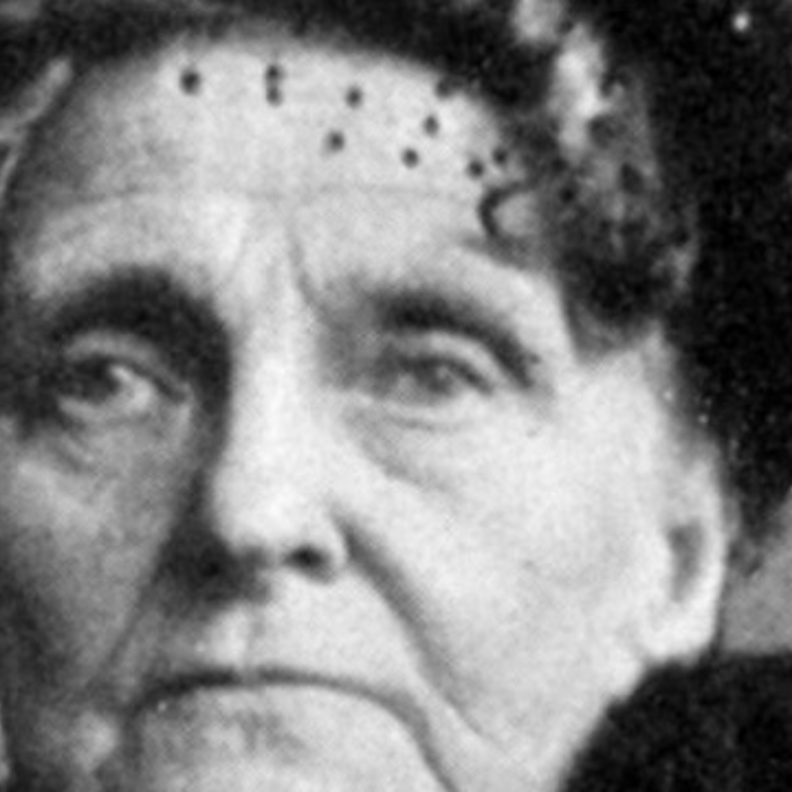 أبخل إمرأة في العالم .. مليونيرة ضحت بساق ابنها! 