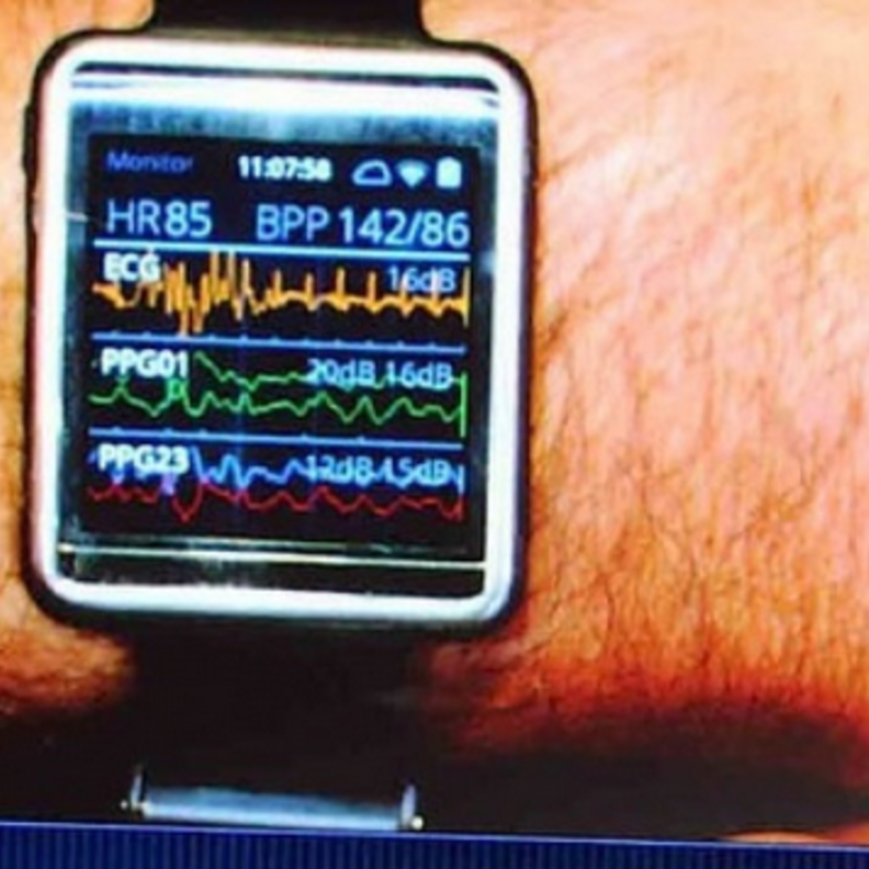 ساعة ذكية طبية