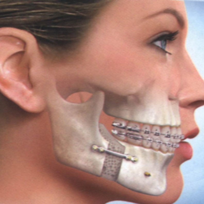 جراحة الفكين