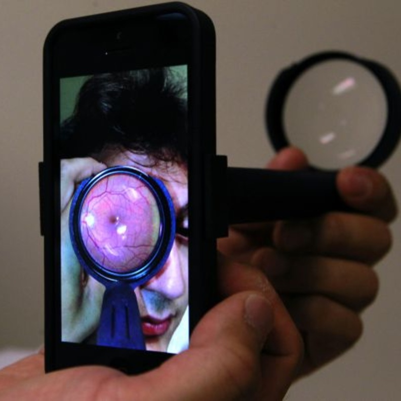 إفحص نظرك بهاتفك الذكي