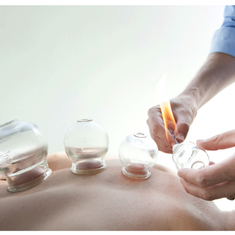 الحجامة وشروط استخدامها في السعودية