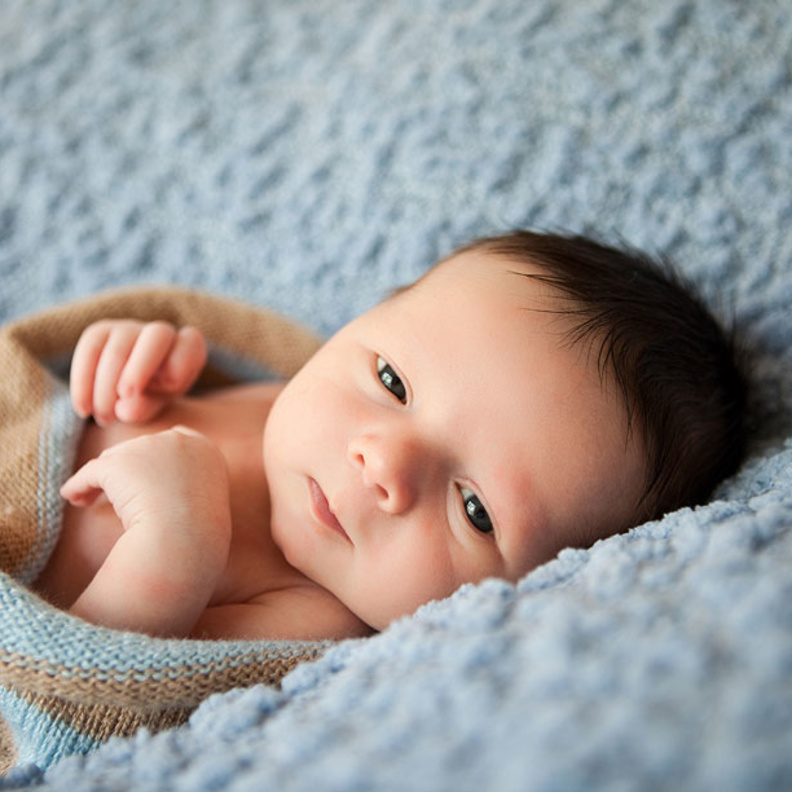 علامات جلدية تظهر على جلد المولود الجديد