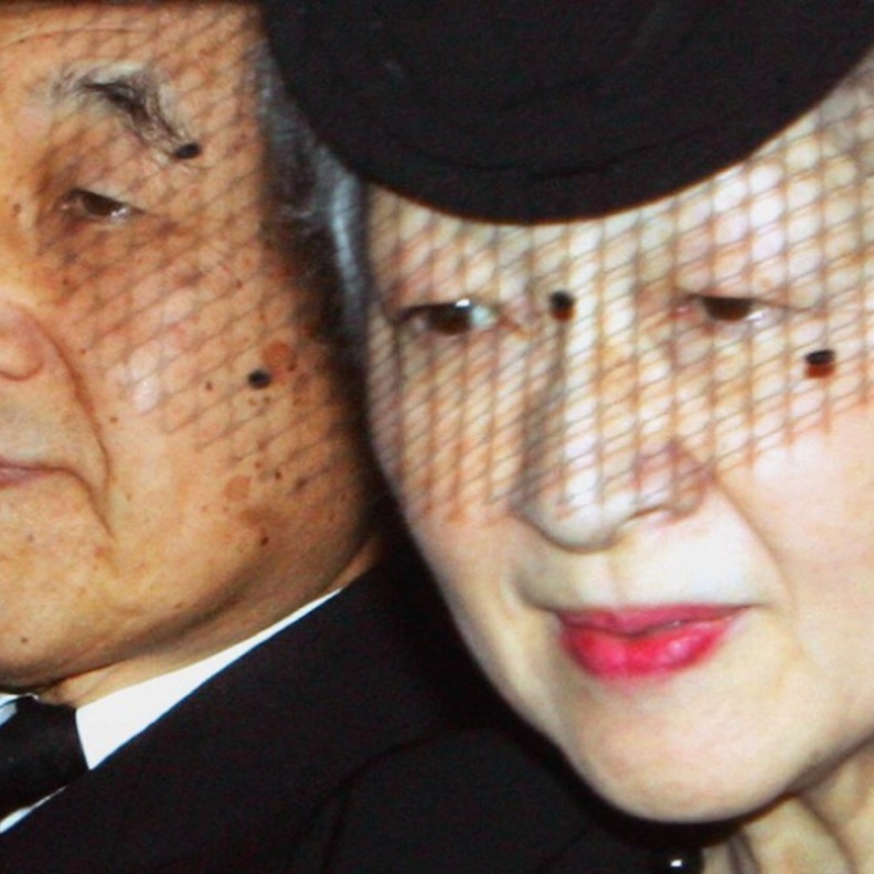 إمبراطور اليابان يعاني من مشاكل صحية كبيرة