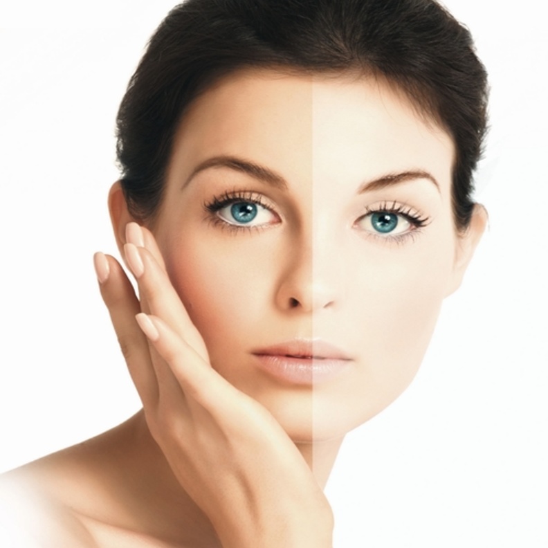 تبيض البشرة أكثر ماتحرص عليه السيدات 