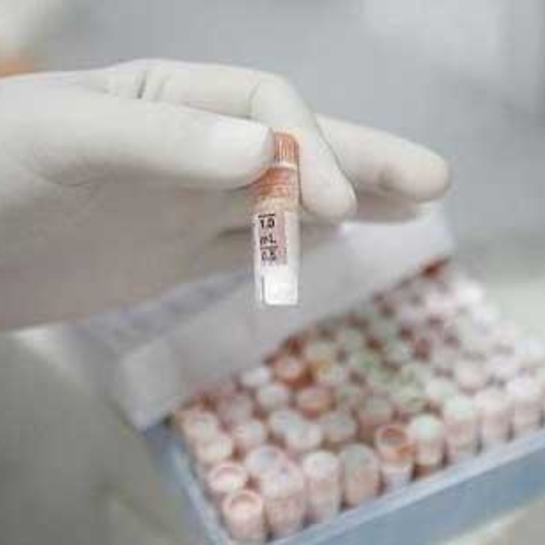 قريبا في المملكة: علاج للسرطان لا يفقد مرضاه الشعر