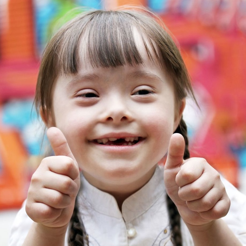 المصابين بمتلازمة داون لاتفارقهم الابتسامة ابدا 