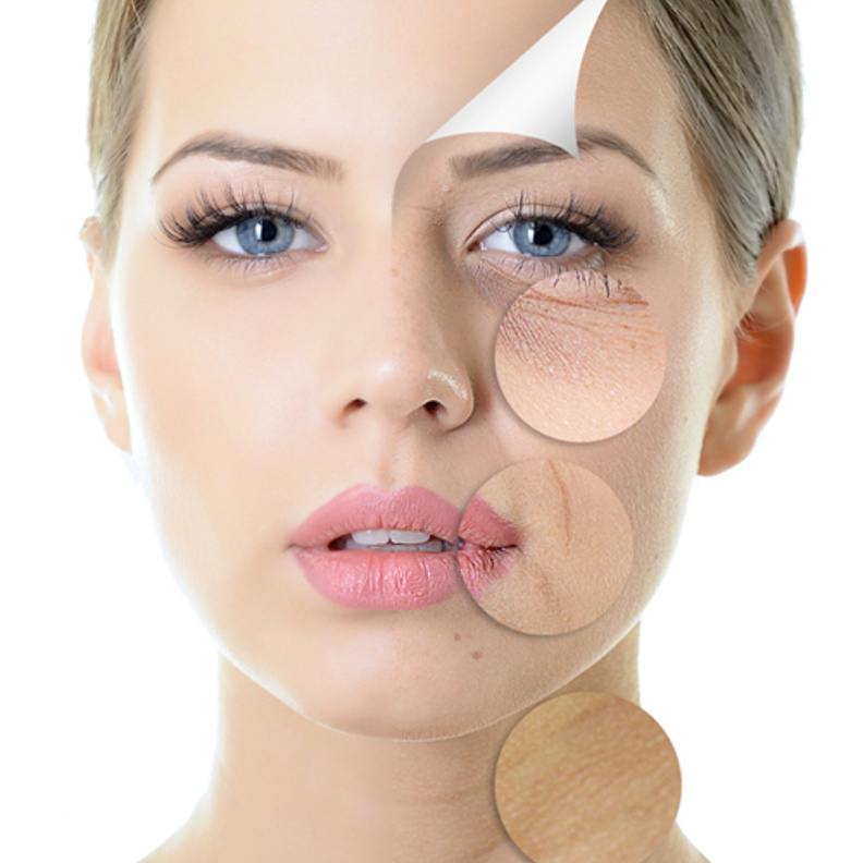 انفوغرافيك: نصائح للعناية بالبشرة الجافة   