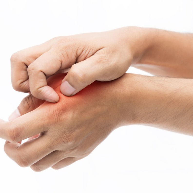 طرق طبيعية لعلاج الحروق الخفيفة في المنزل