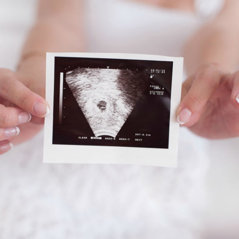 يمكن قياس نبض الجنين من الاسبوع 8 من الحمل