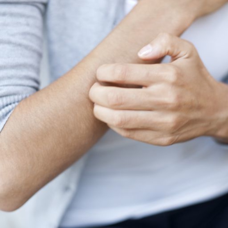  الطفح الجلدي يمكن علاجه بالأشعة الفوق بنفسجية