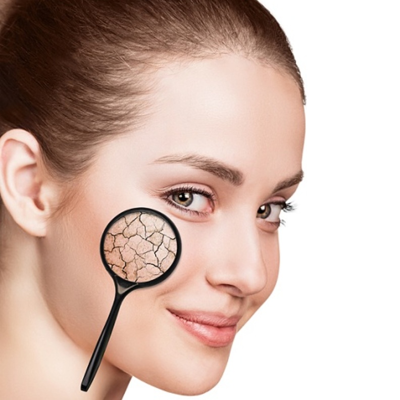 جفاف البشرة