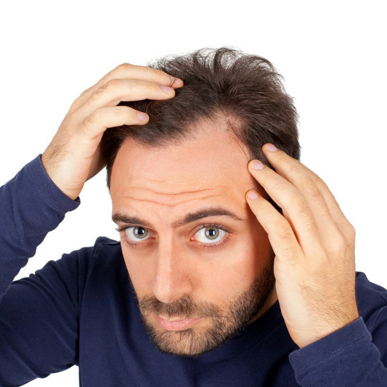 زراعة الشعر الطريقة العلاجية التي غالبا ما يلجأ إليها من يعانون من الصلع