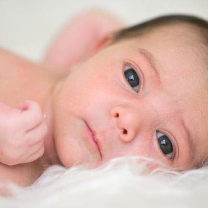 اسباب التهاب عيون الاطفال الرضع 