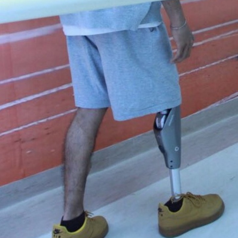 الركبة الالكترونية أحدث تقنيات التأهيل في السعودية