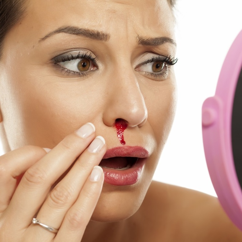 اسباب نزيف الانف المفاجئ