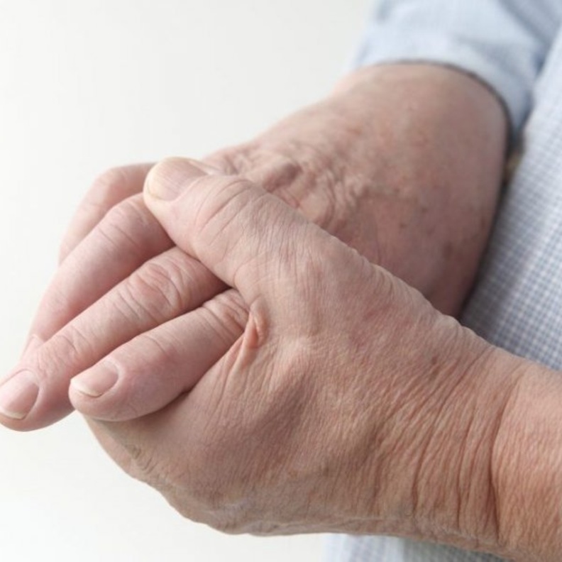 علاج التهاب المفاصل الروماتويدي