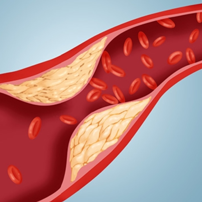 الخضروات الطازجة تحد من تأثير الكولسترول الضار
