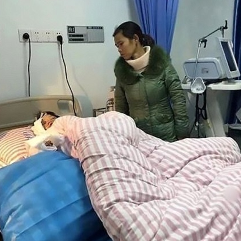 عملية جراحية استغرقت 5 ساعات لإنقاذ الطفل المصاب