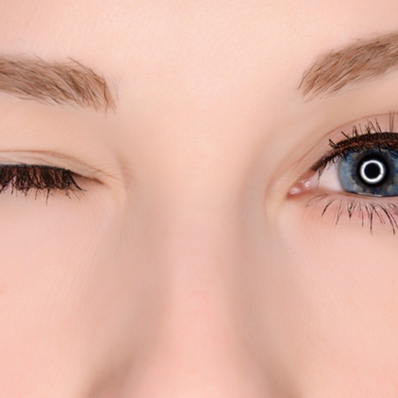 مرض القرنية المخروطية عند الشباب