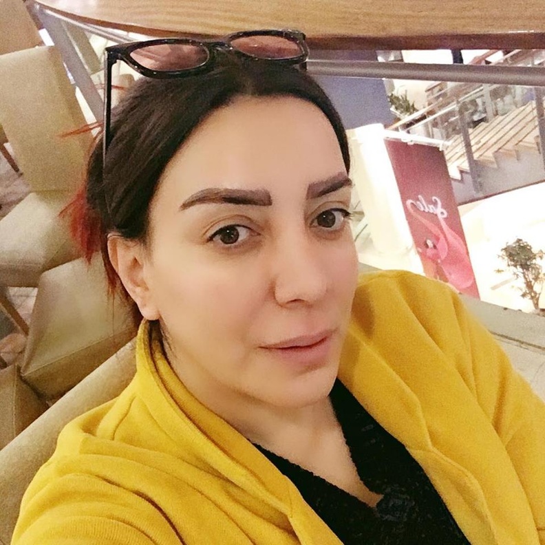 شكران مرتجى ترد على عمليات التجميل