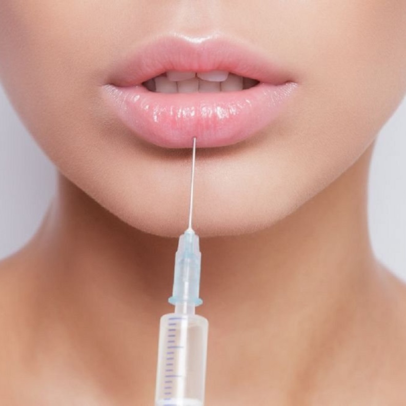الفيلر لتكبير الشفاه
