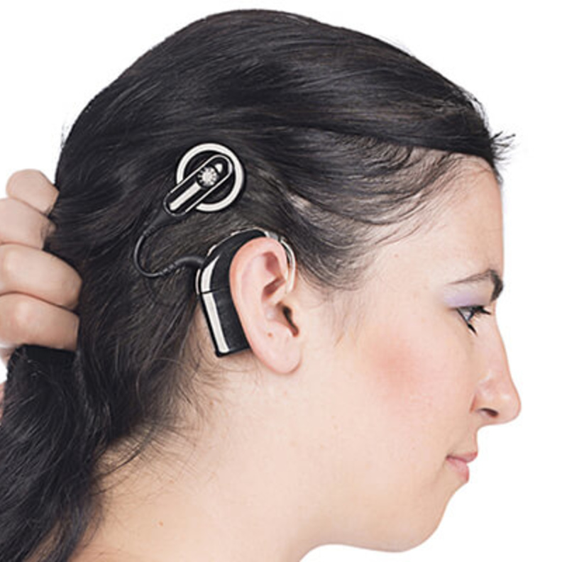  زراعة القوقعة يجب أن يكون بعدها برنامج تأهيل سمعي